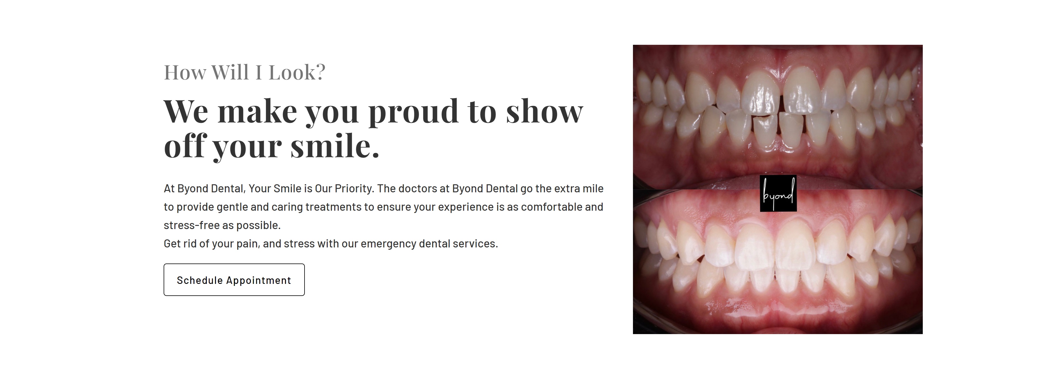  Houston dental crown