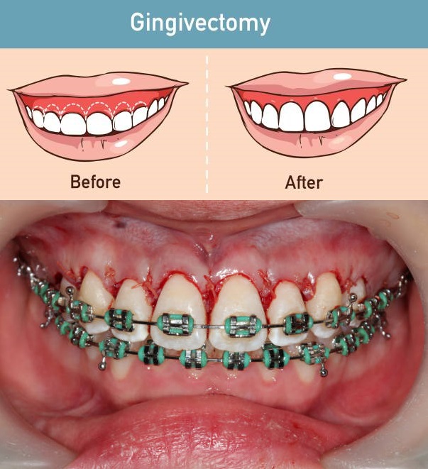 Clear Lake dentist